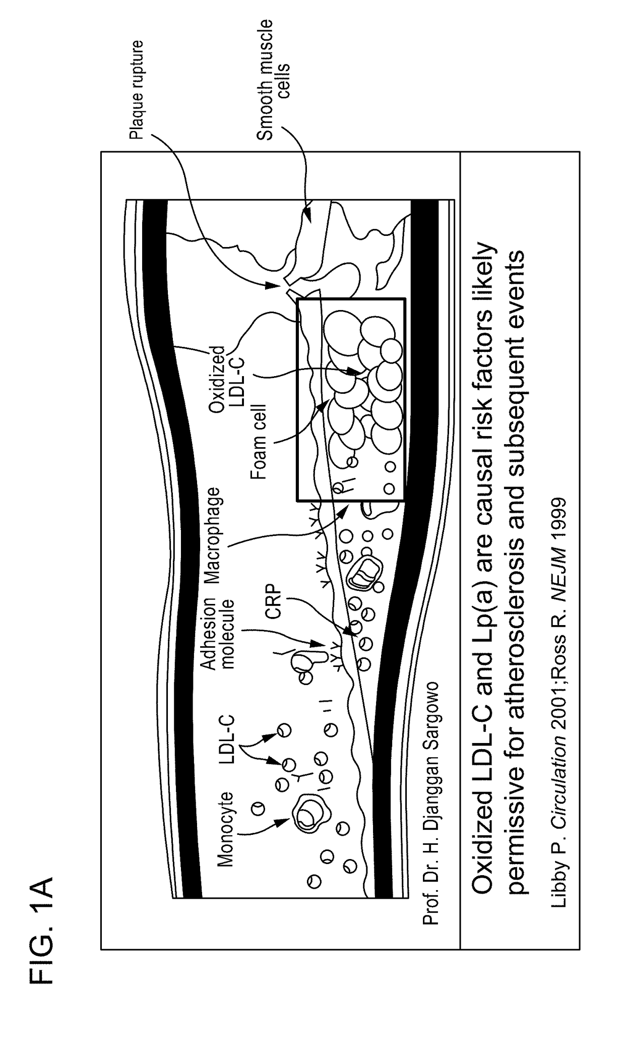 Methods and kits for treating cardiovascular disease