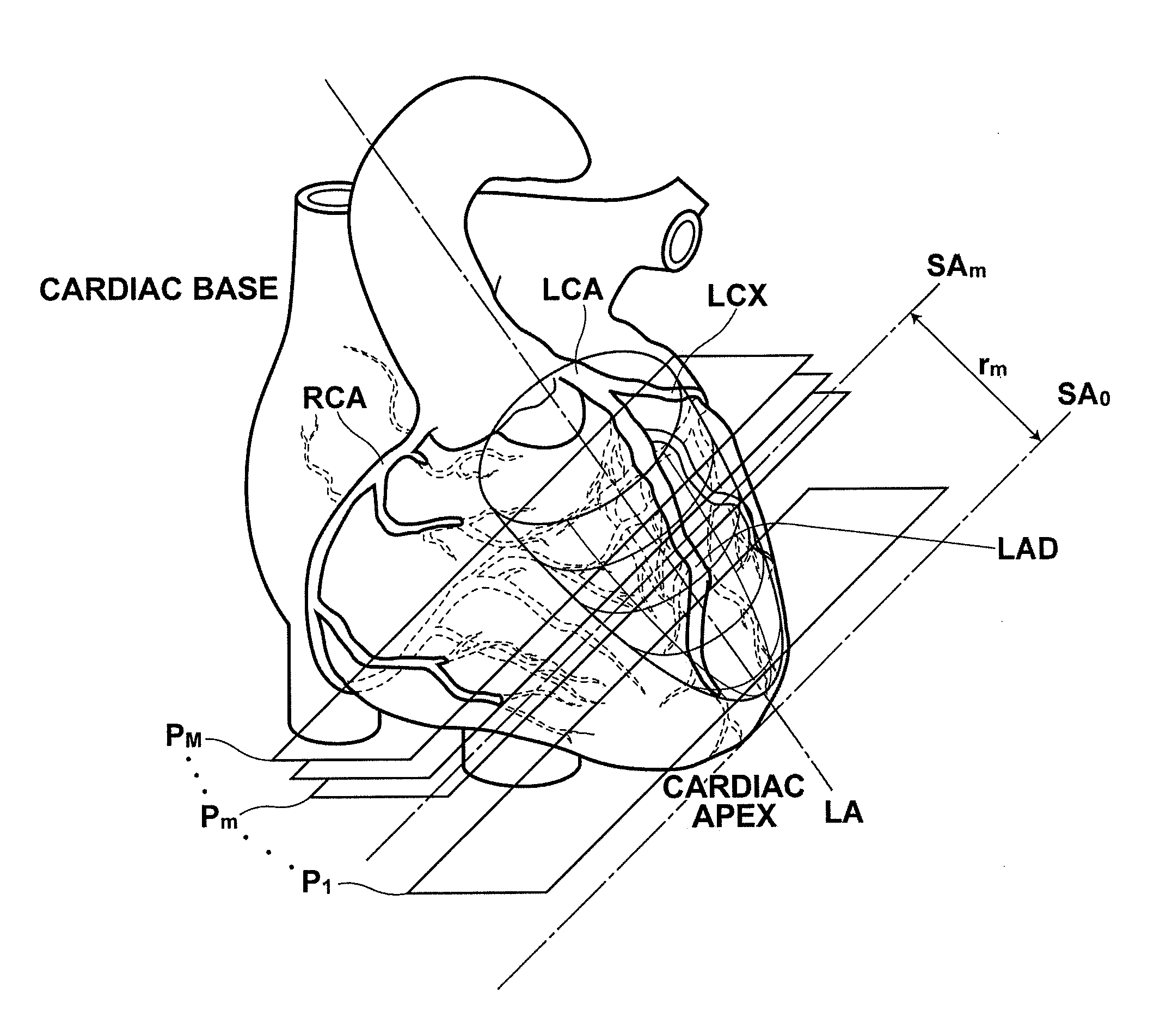 Medical image diagnosis assisting apparatus, method, and program