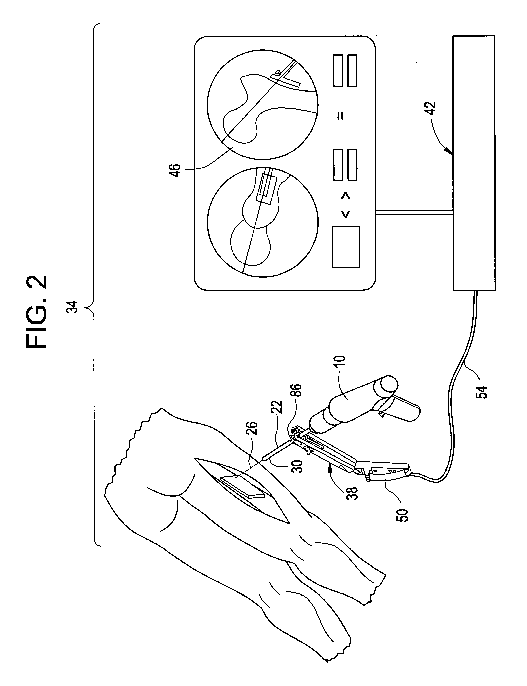 Universal attachment mechanism for attaching a tracking device to an instrument