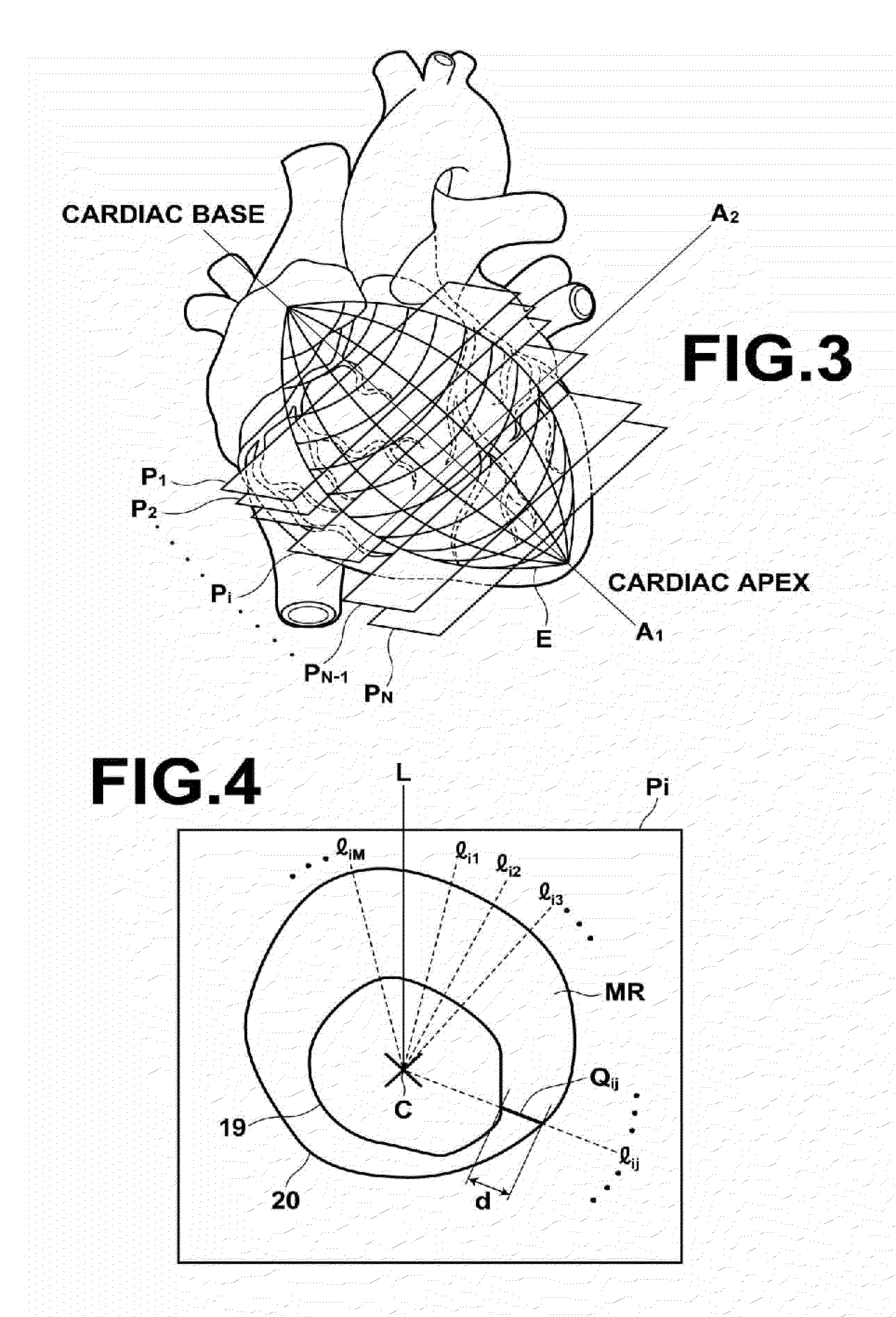 Image processing apparatus, image processing method, and image processing program