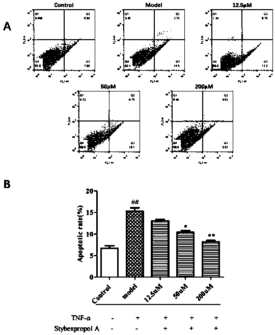 Compound stybenpropol a and its application in preventing and treating atherosclerosis