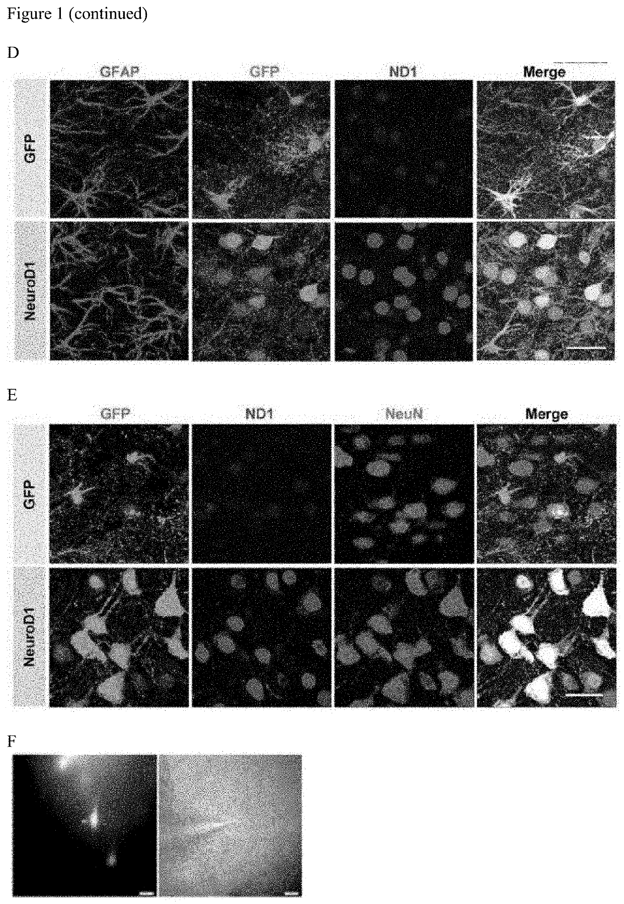 Regenerating functional neurons for treatment of neurological disorders