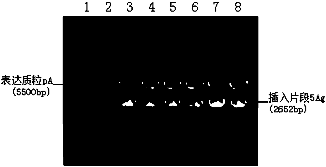 Recombinant tuberculosis vaccine, preparation method and application thereof