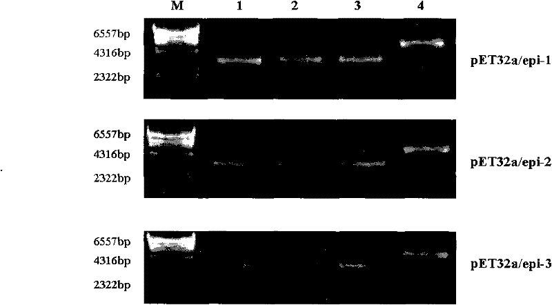 Epitope of Epstein-Barr virus latent membrane protein 2b and its application