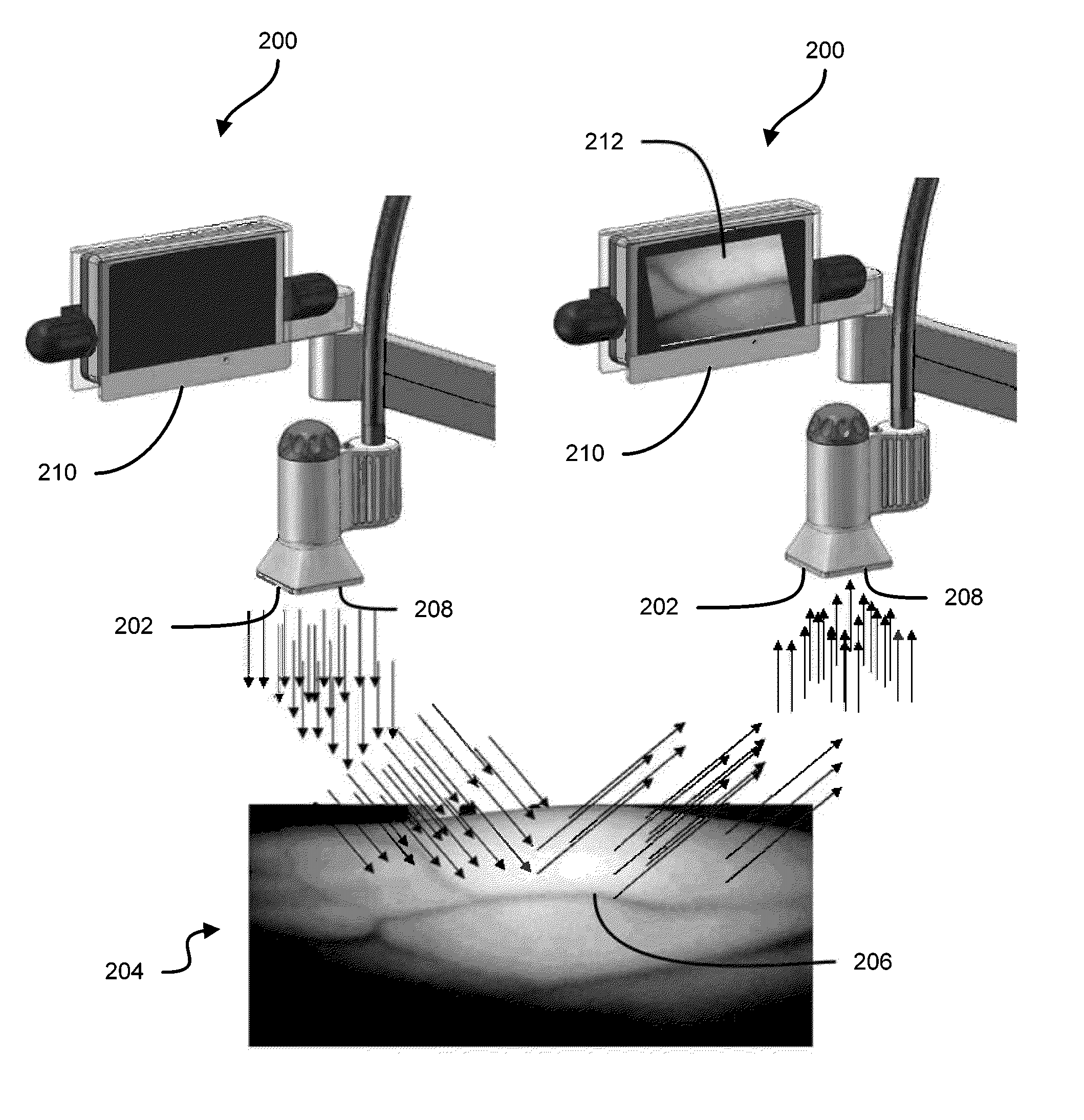 Vein imaging systems and methods