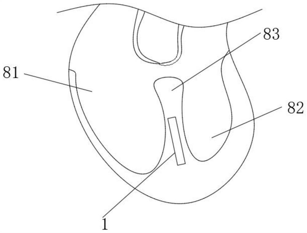 Pacemaker and implantation method thereof