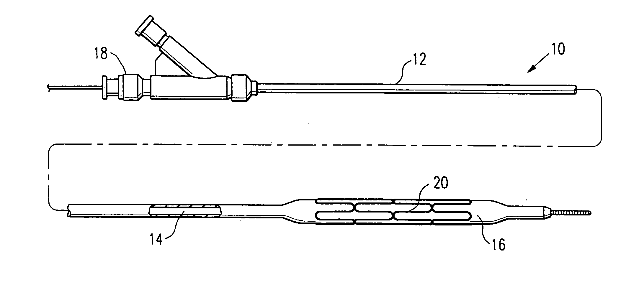 Contraceptive system and method of use