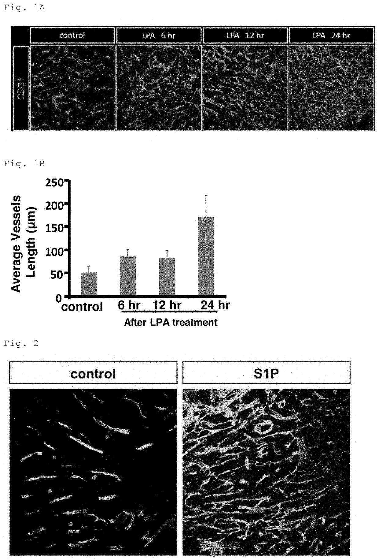 Drug delivery enhancer comprising substance for activating lysophospholipid receptors