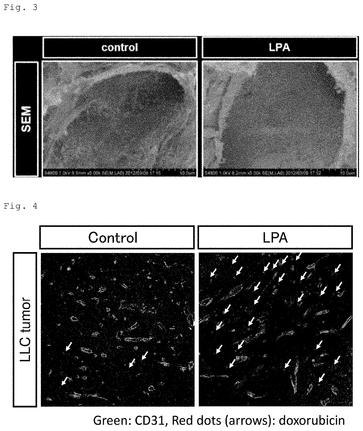 Drug delivery enhancer comprising substance for activating lysophospholipid receptors