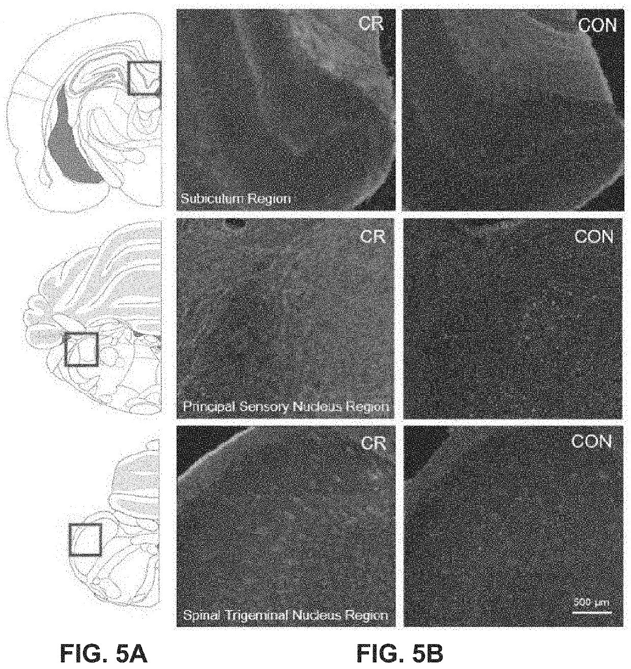 Generation of personalized neuroprotective and cardioprotective nutrition programs featuring caloric restriction