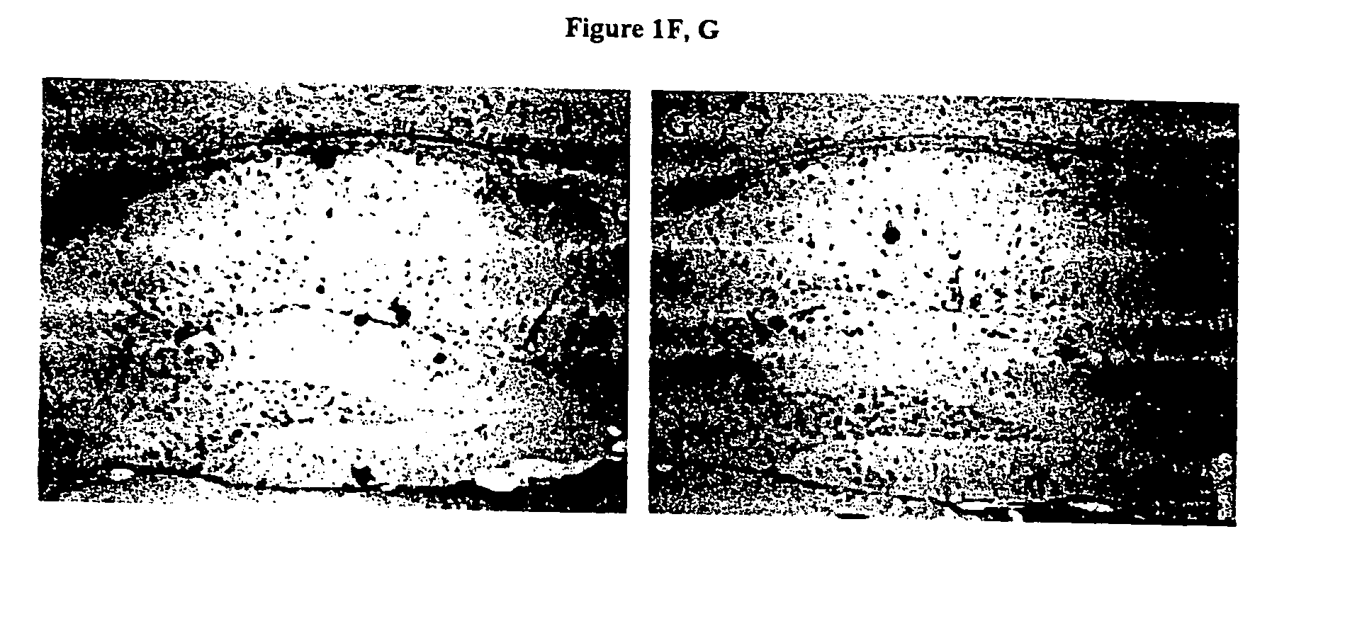 Compositions and methods for treatment of disorders of protein aggregation