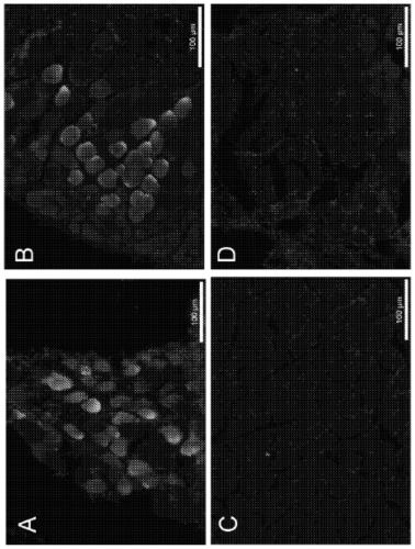 DNA antibody constructs for use against pseudomonas aeruginosa