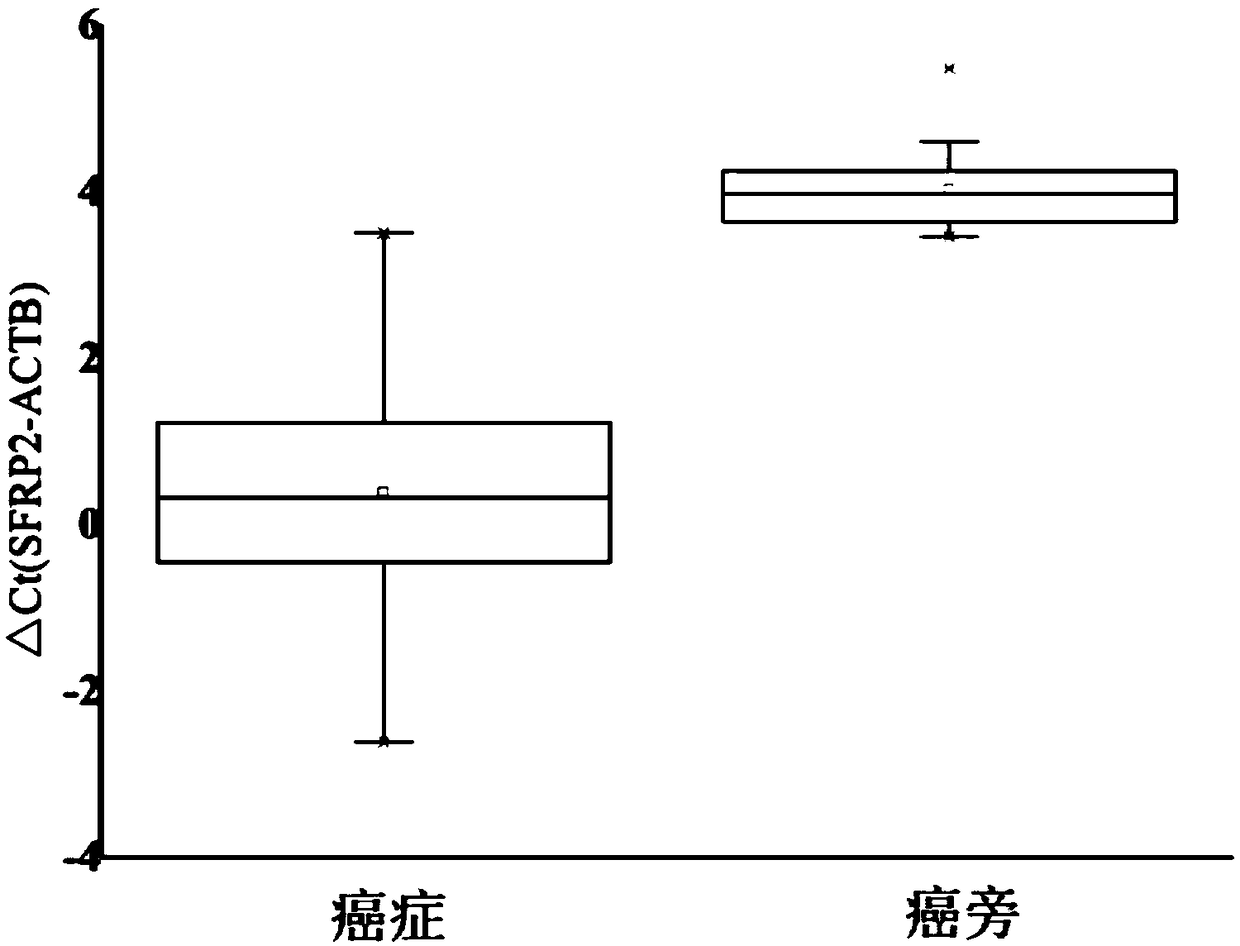 Primer and probe set for diagnosis, detection or screening of digestive tract cancer