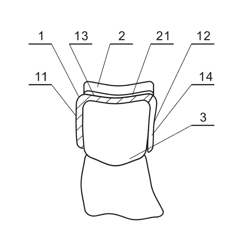 Tooth socket for protecting teeth