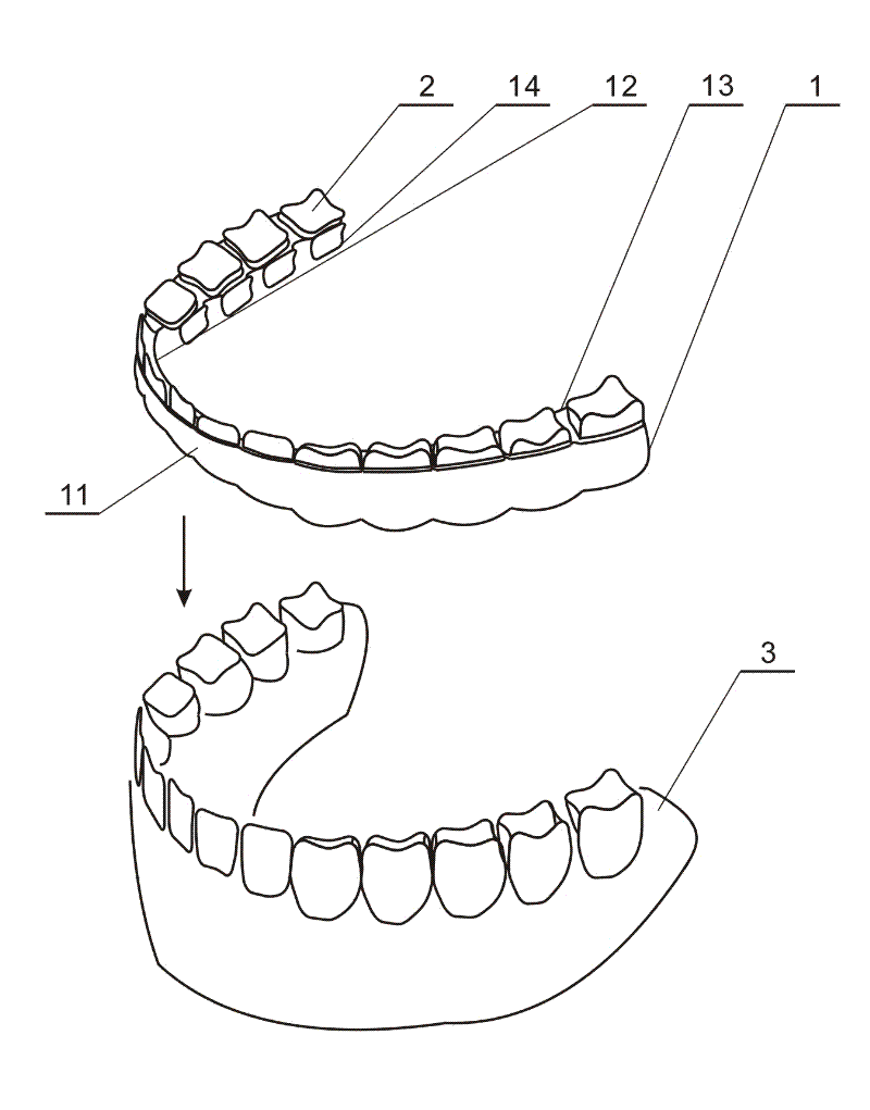 Tooth socket for protecting teeth