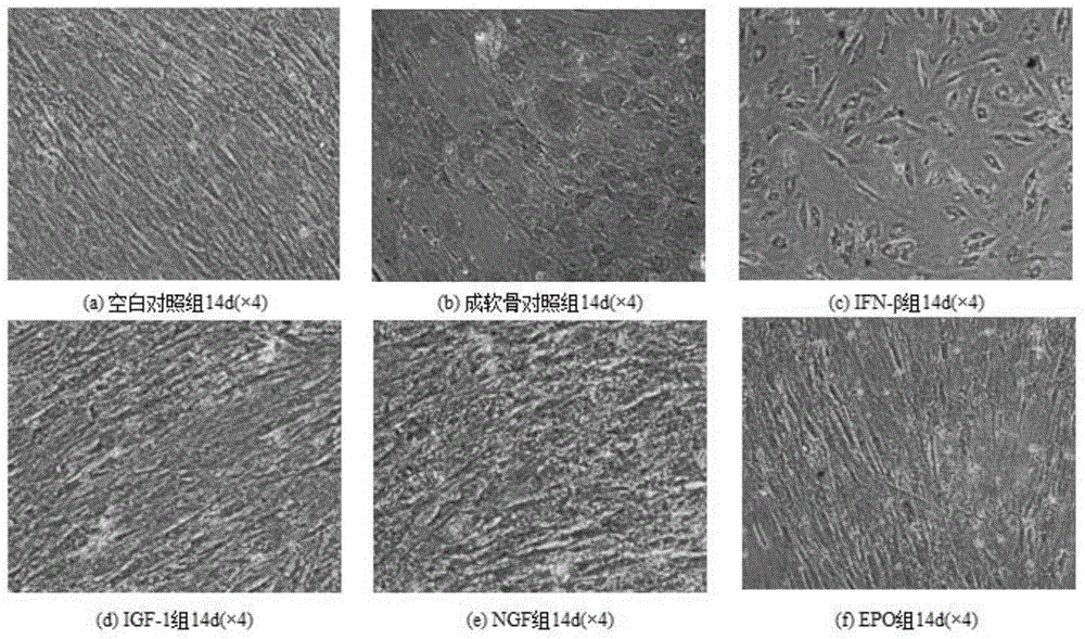 Bone-repairing material for customizing and preparation method thereof