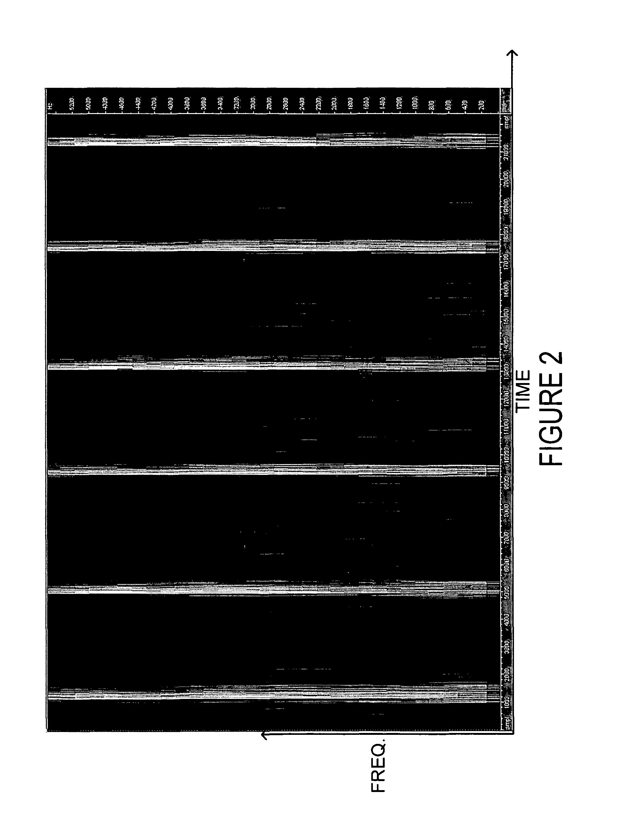 Repetitive transient noise removal