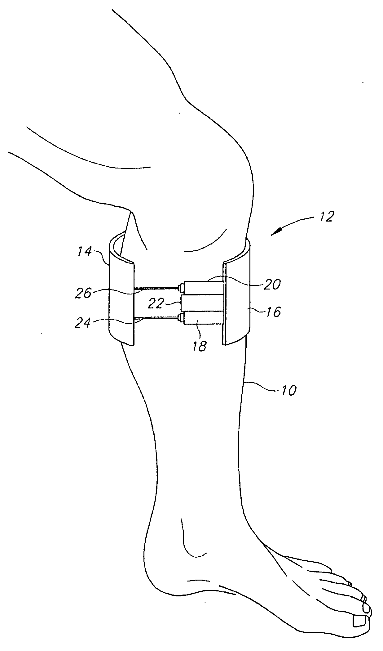 Portable device for the enhancement of circulation