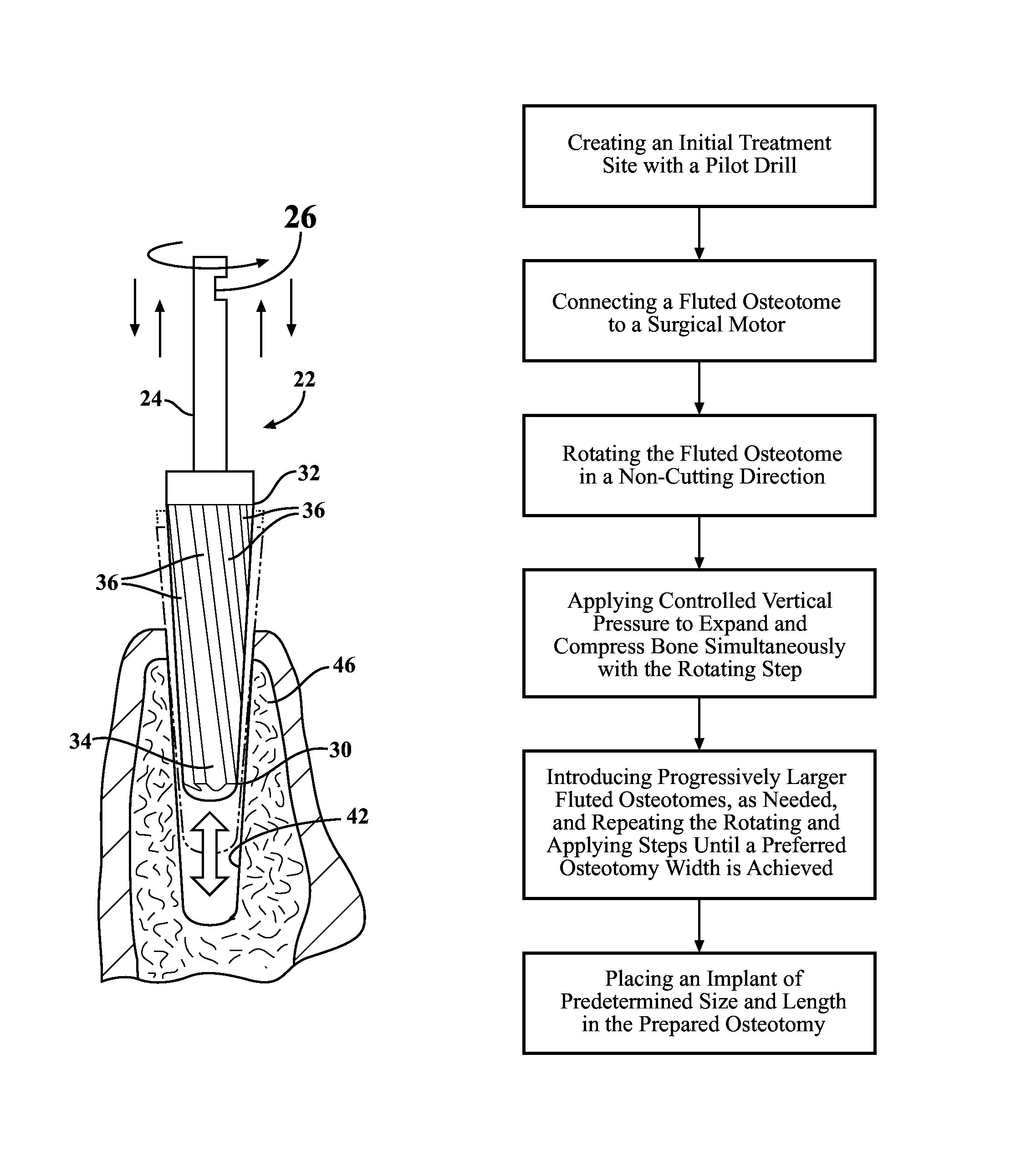 Fluted osteotome and surgical method for use