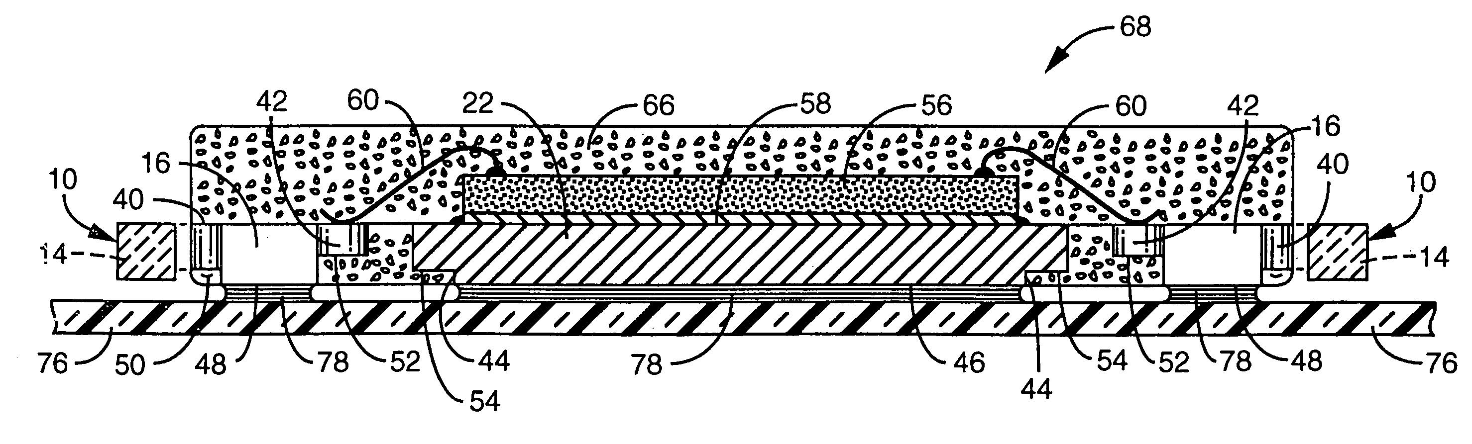 Semiconductor package with exposed die pad and body-locking leadframe