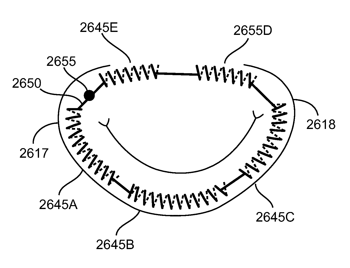 Minimally invasive procedure for implanting an annuloplasty device