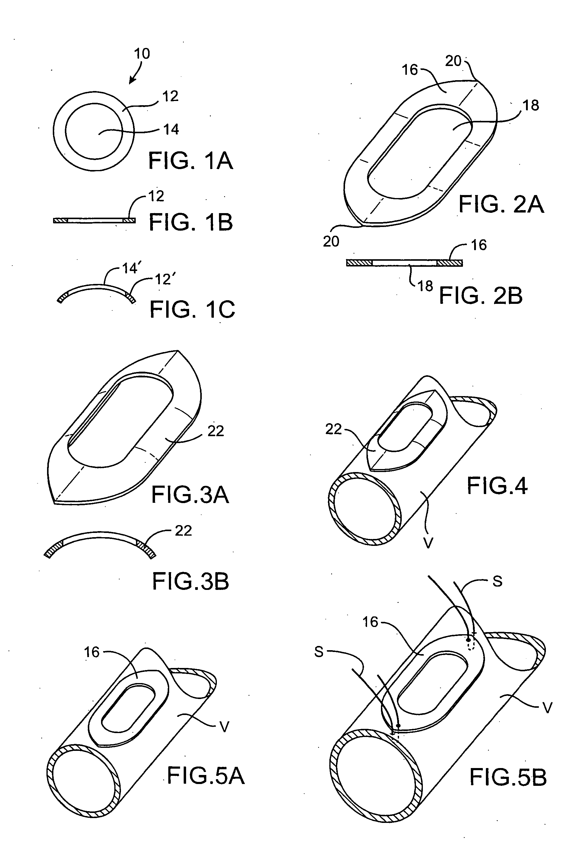 Extravascular anastomotic components and methods for forming magnetic anastomoses