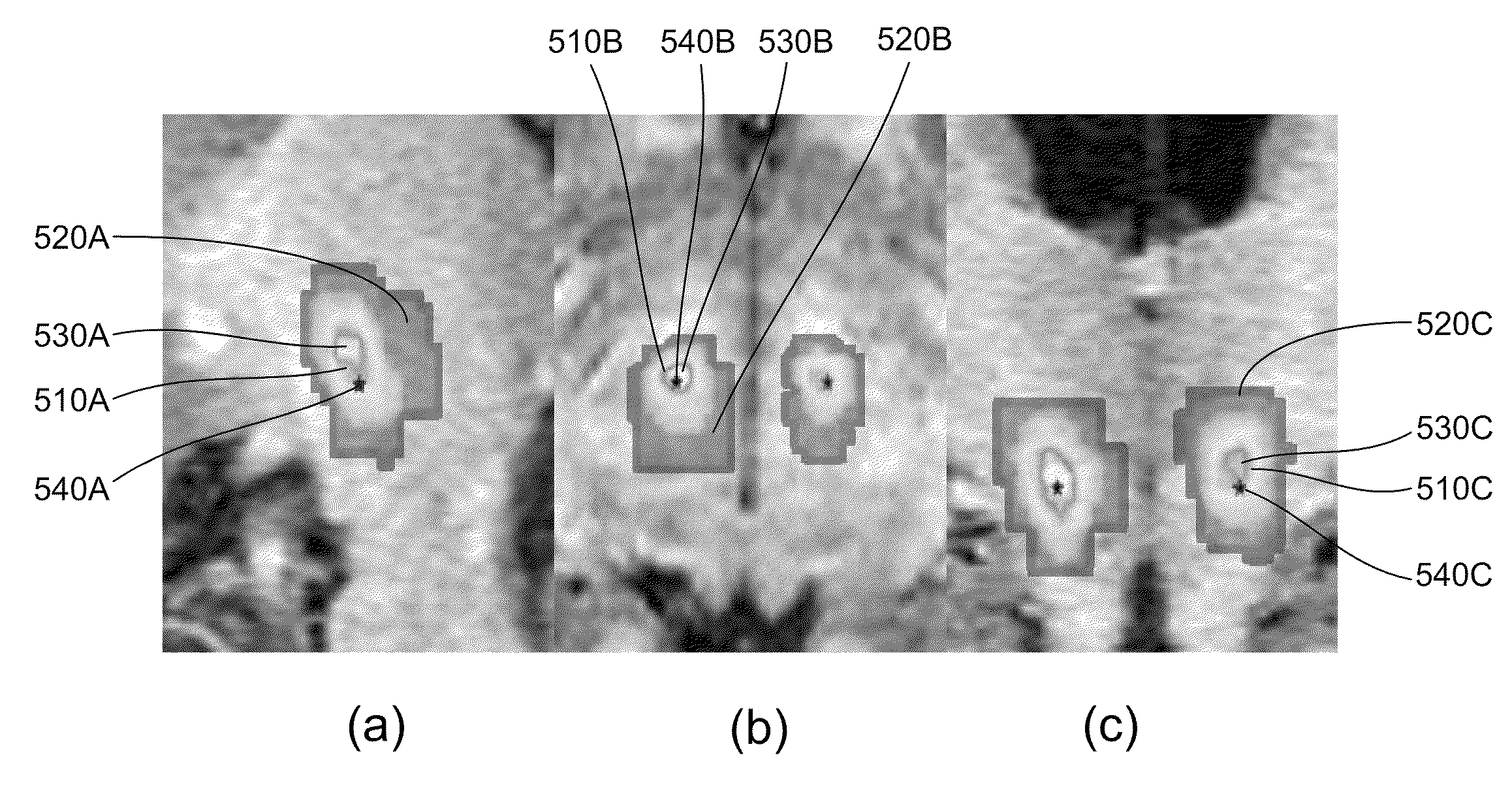 System and methods of deep brain stimulation for post-operation patients