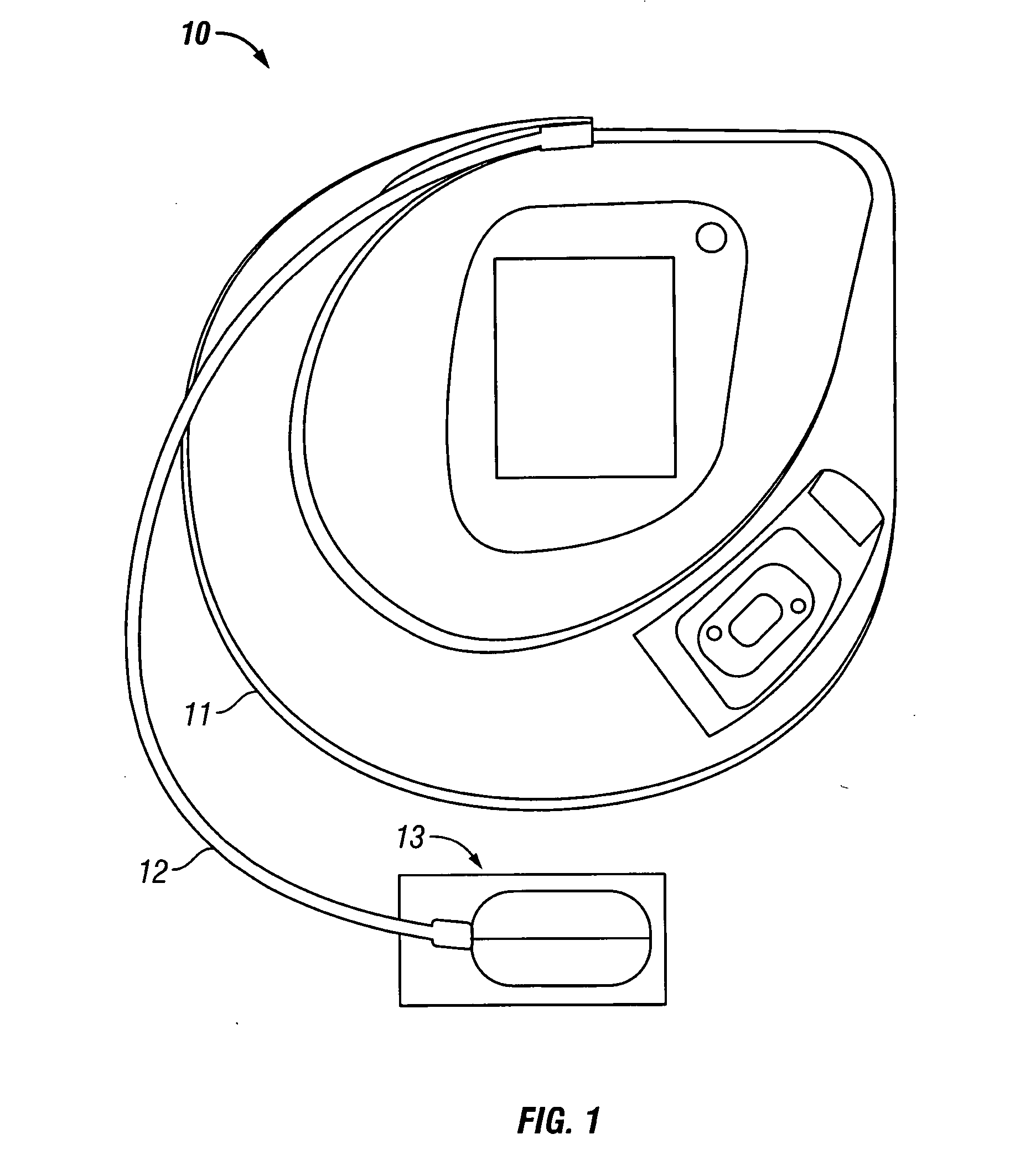 Method and apparatus for noninvasive glucose concentration estimation through near-infrared spectroscopy