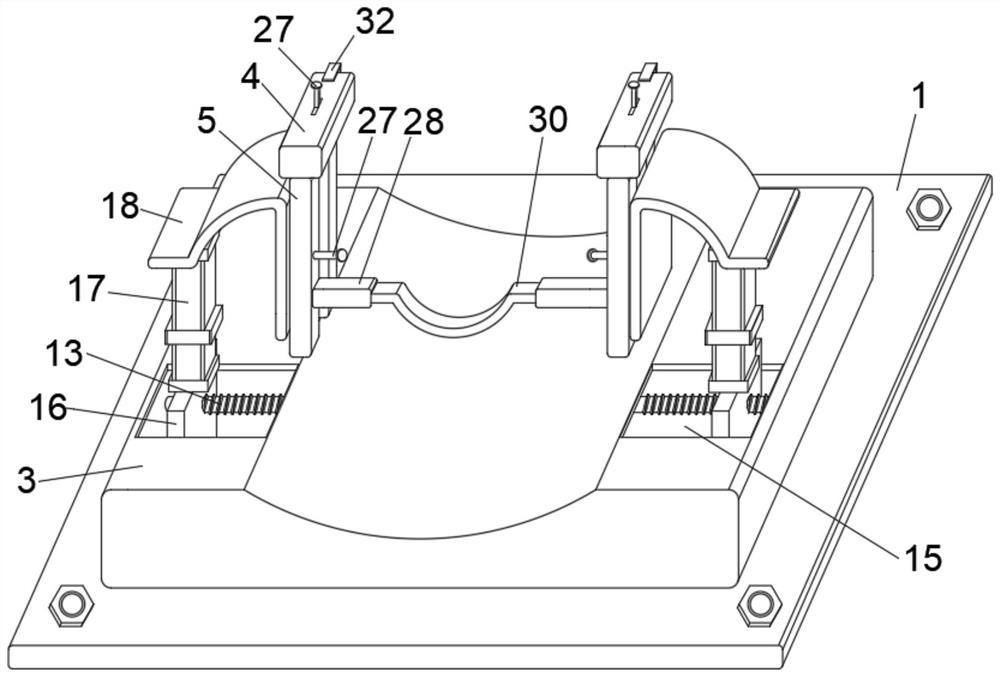 Distraction device for oral and maxillofacial surgery