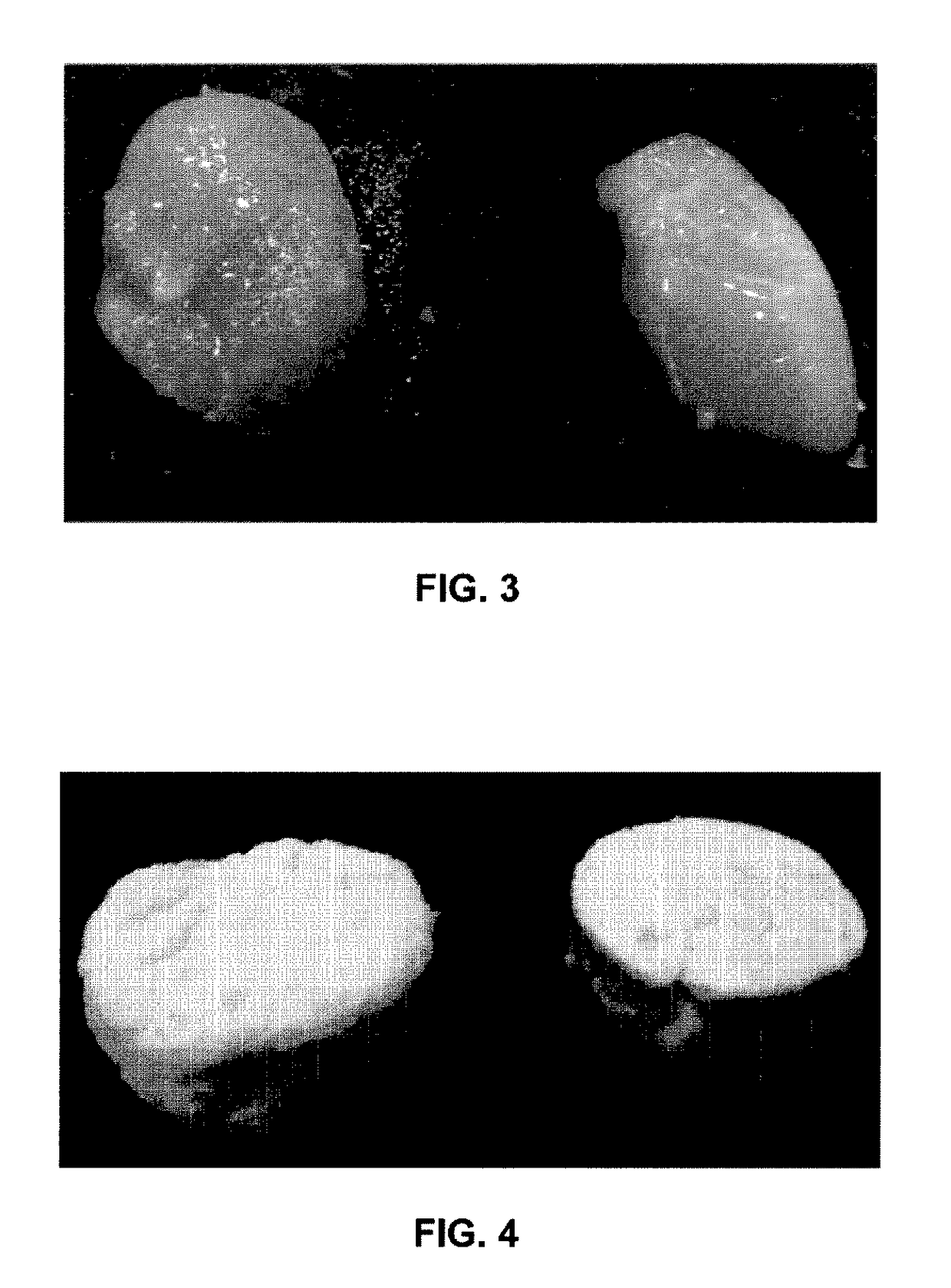 Healthy food compositions having gel or foam textures and comprising hydrolyzed egg products