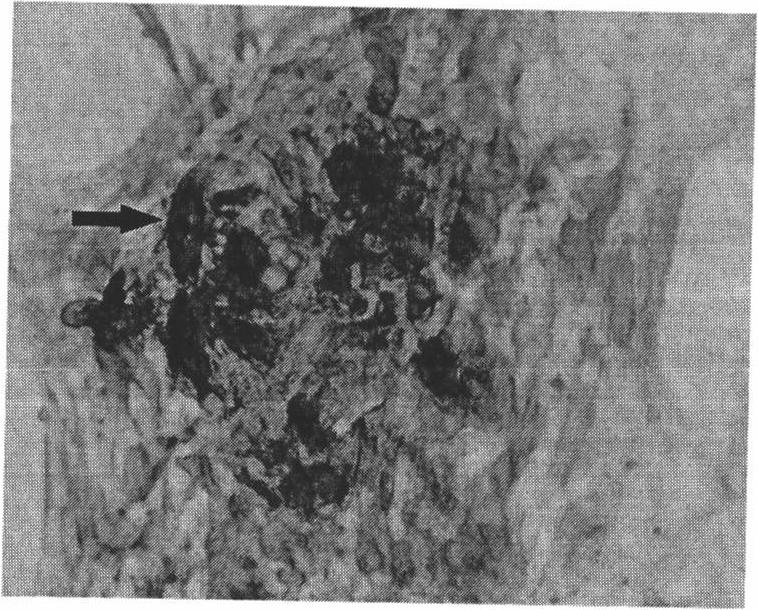 Kit for inducing differentiation from bone mesenchymal stem cells to osteoblasts, application of kit and method for inducing cell differentiation