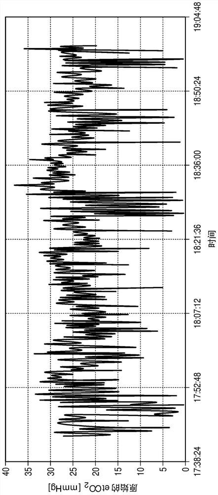 Simplified display of end tidal co2