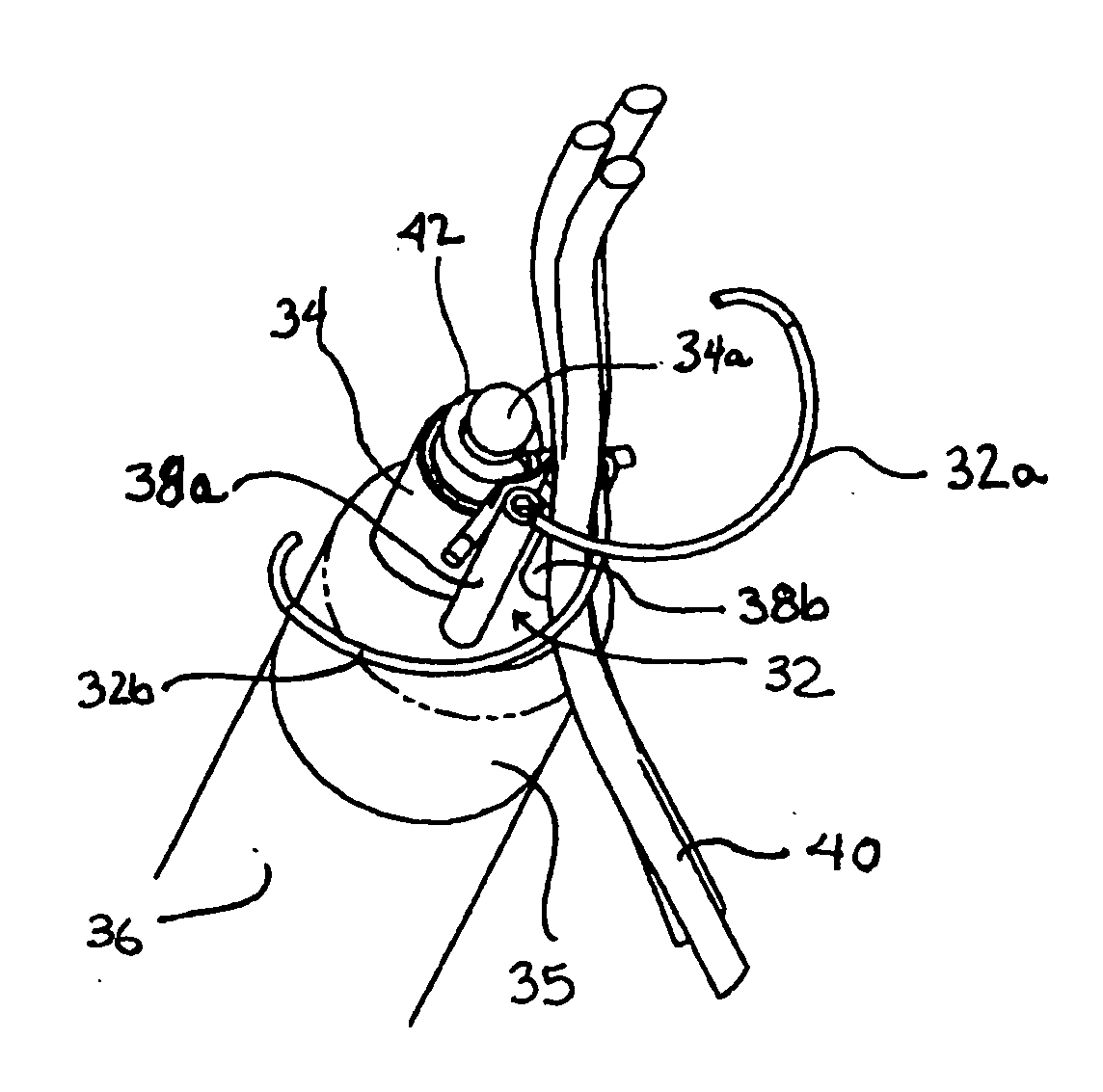 Devices and methods of repairing cardiac valves