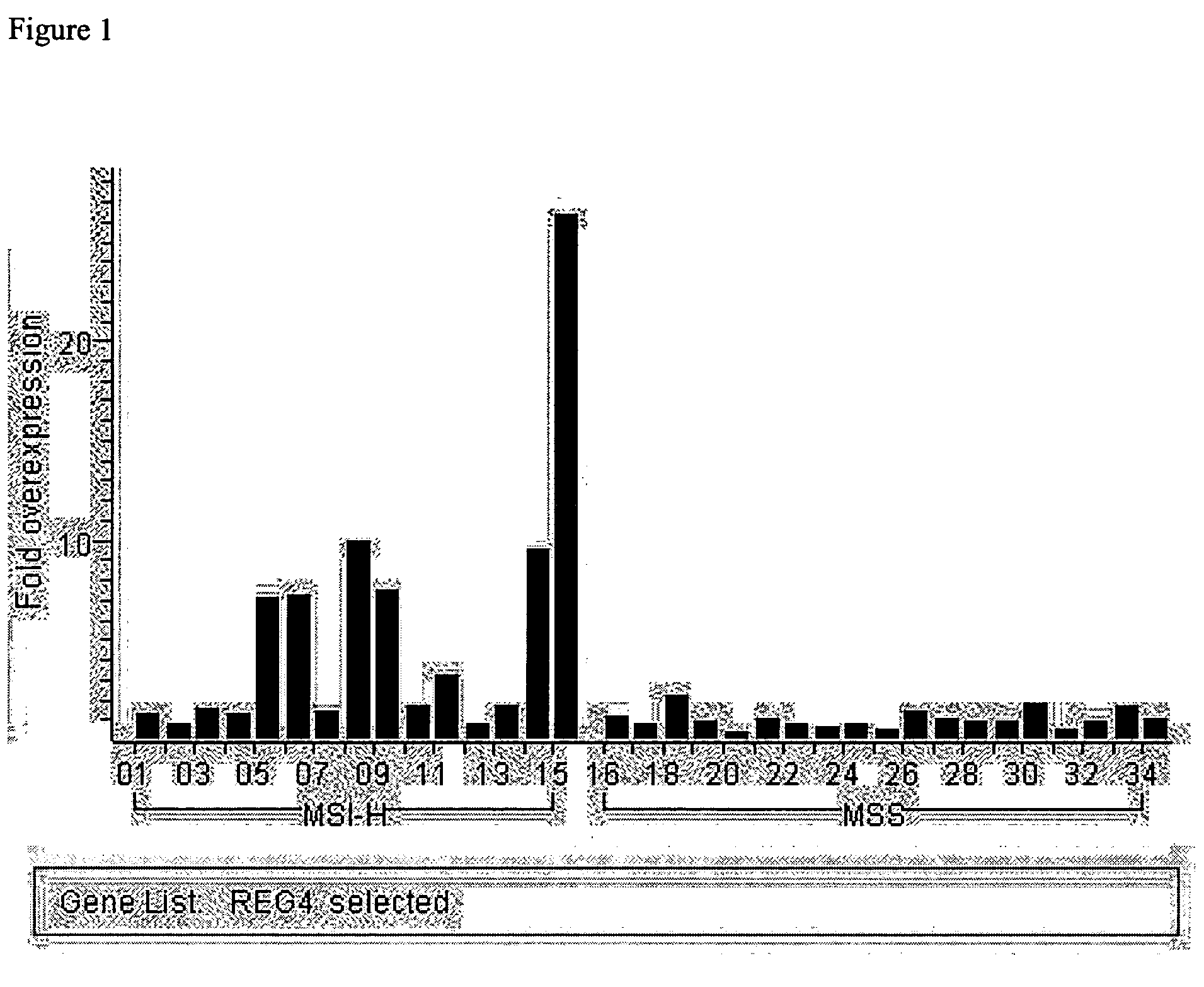 Differential expression of genes in microsatellite instability