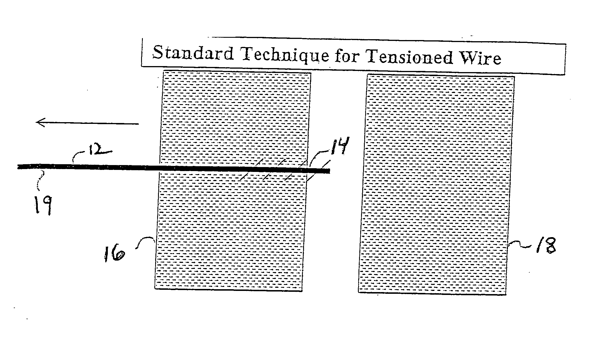 Method and device for bone stabilization using a threaded compression wire