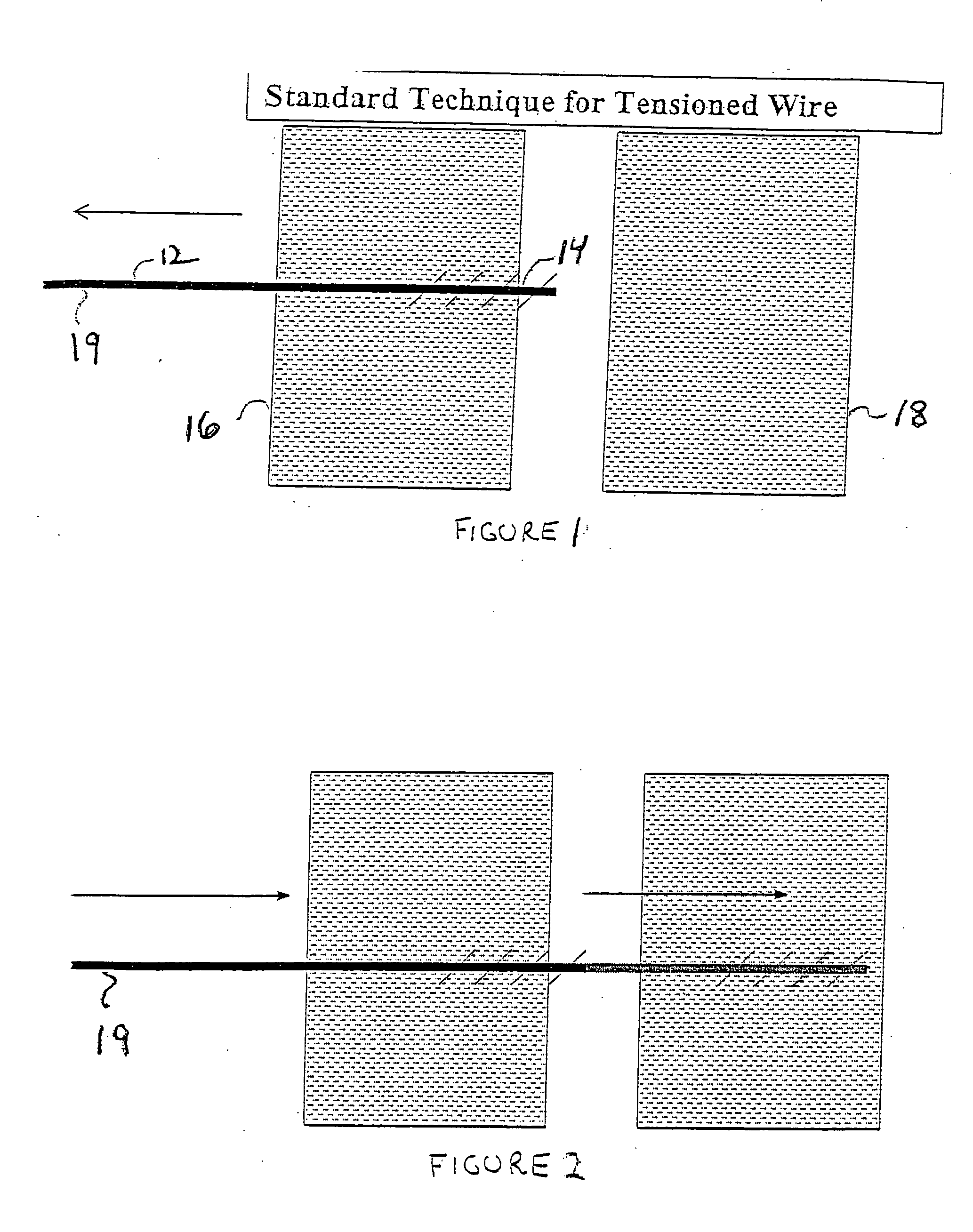 Method and device for bone stabilization using a threaded compression wire