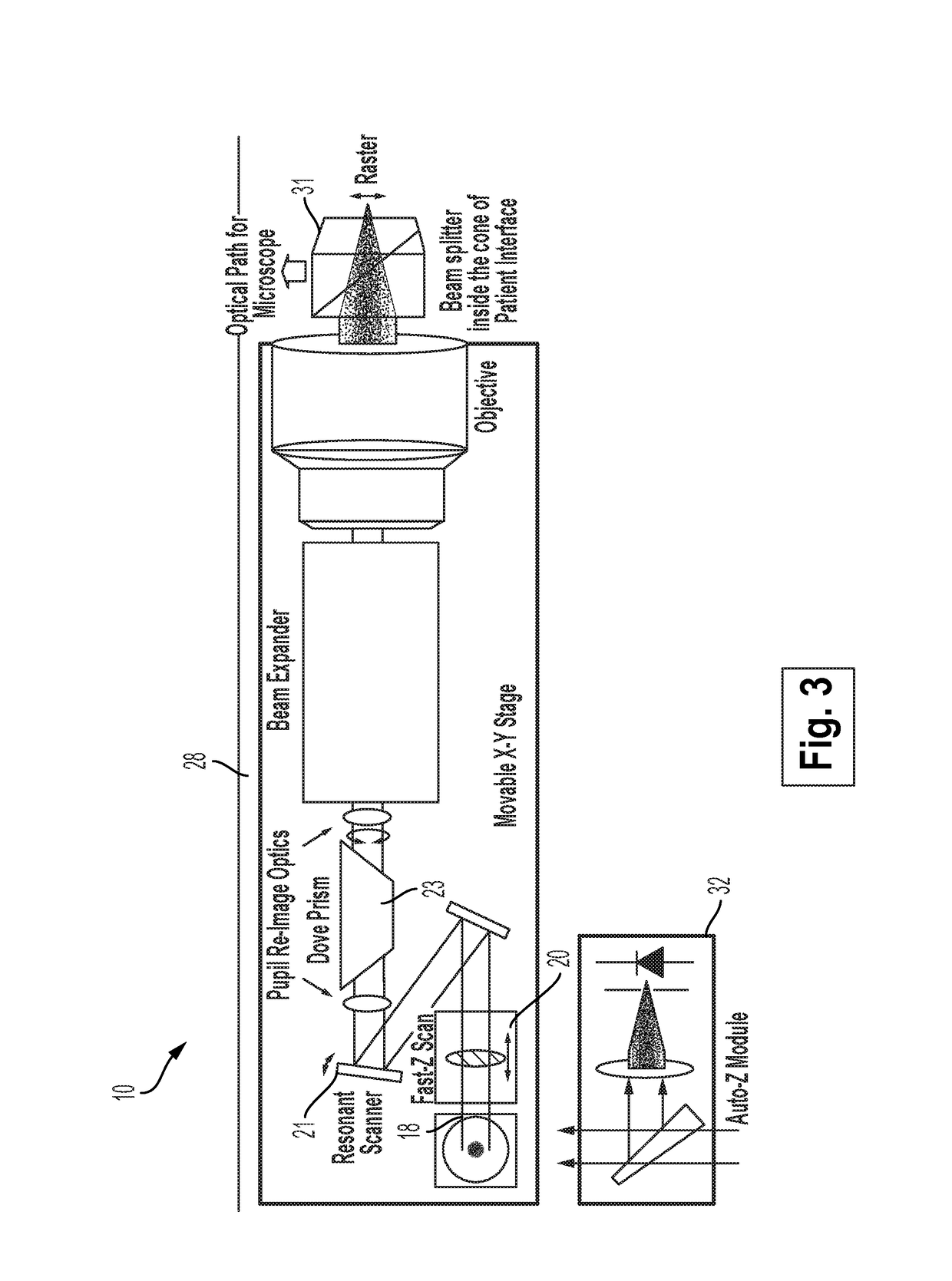 Systems and methods for lenticular laser incision