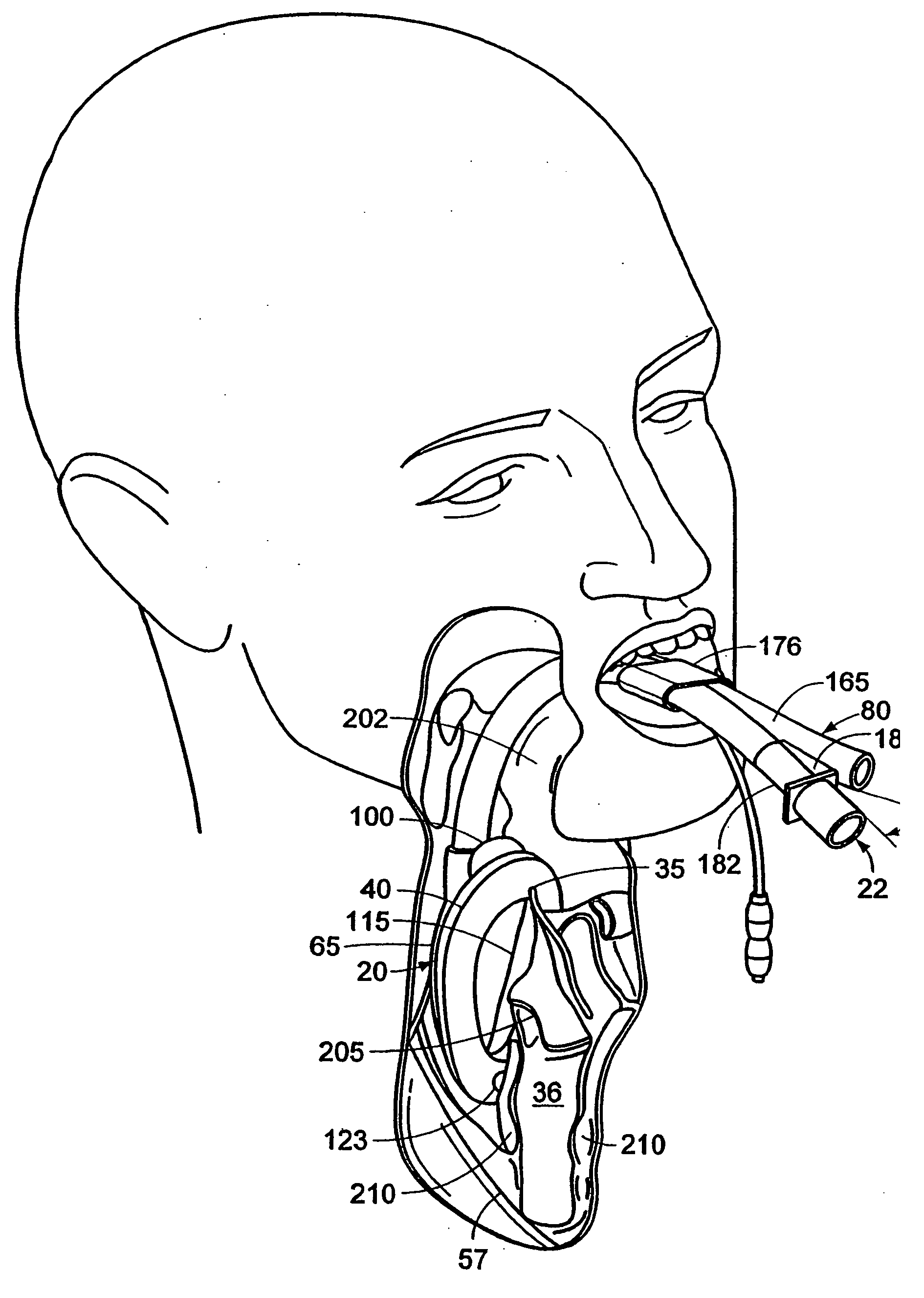 Laryngeal mask airway device