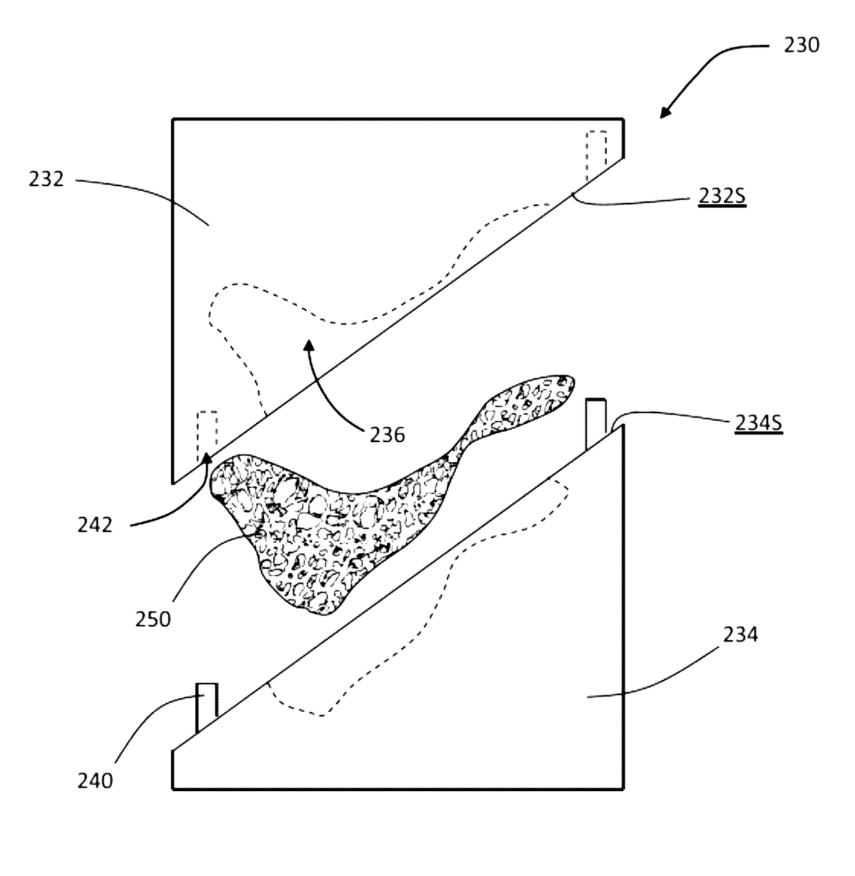 Patient-specific manufacturing of porous metal prostheses