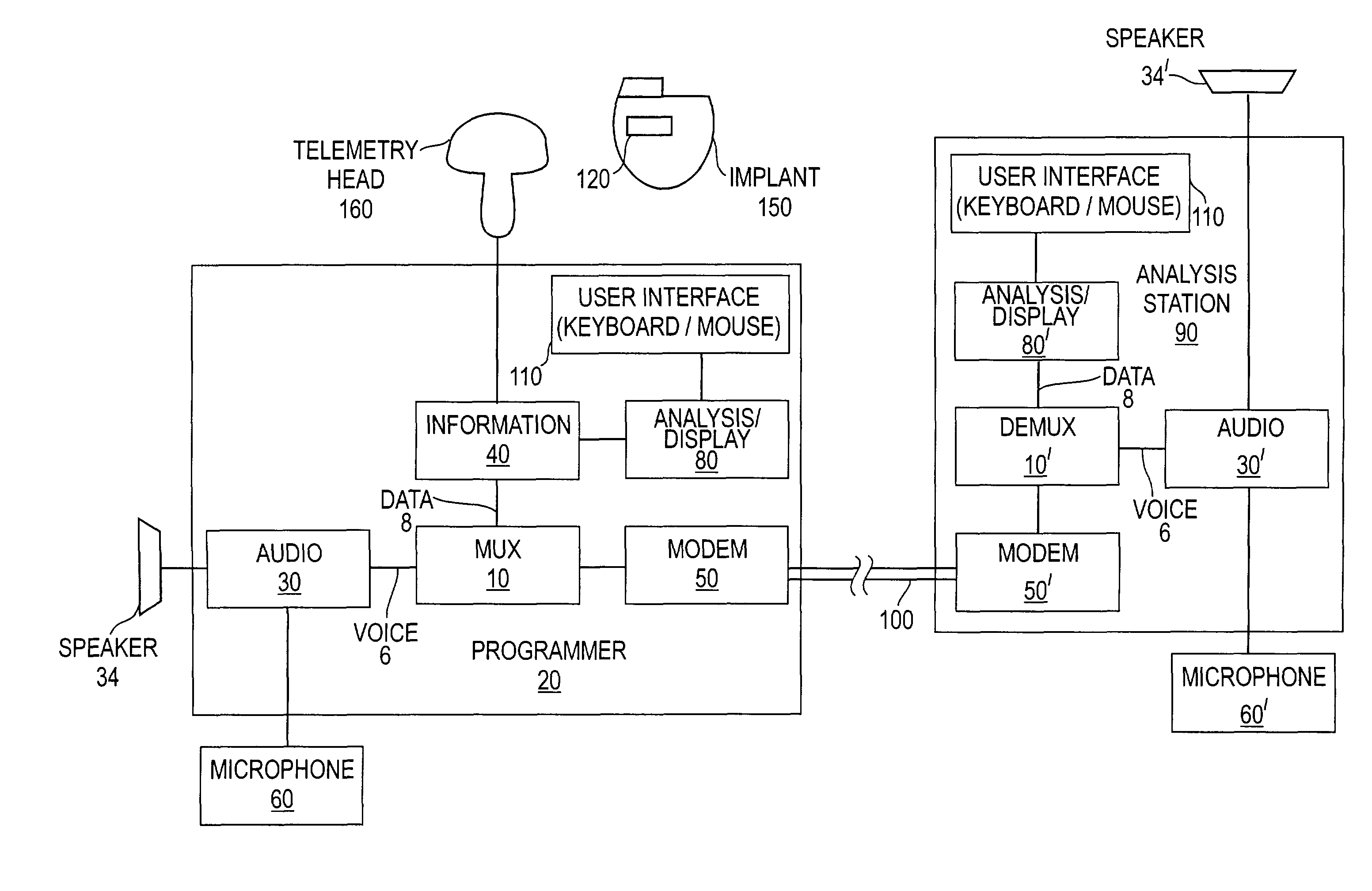 Remote support system for programming active implantable medical devices such as cardiac pacemakers, defibrillators, cardiovertors or multisite devices