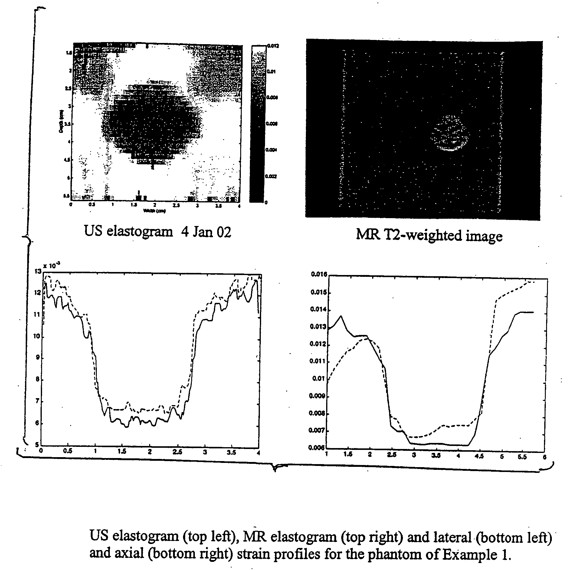 Tissue mimicking elastography phantoms