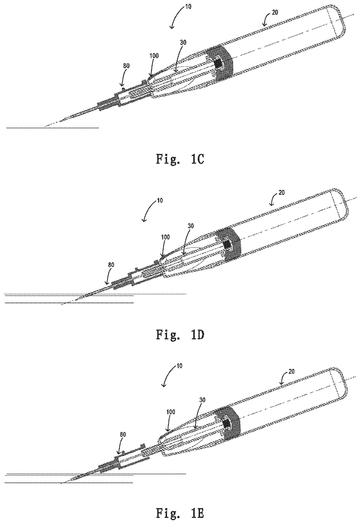 Safety mechanism for a retaining needle and a retaining needle having the safety mechanism