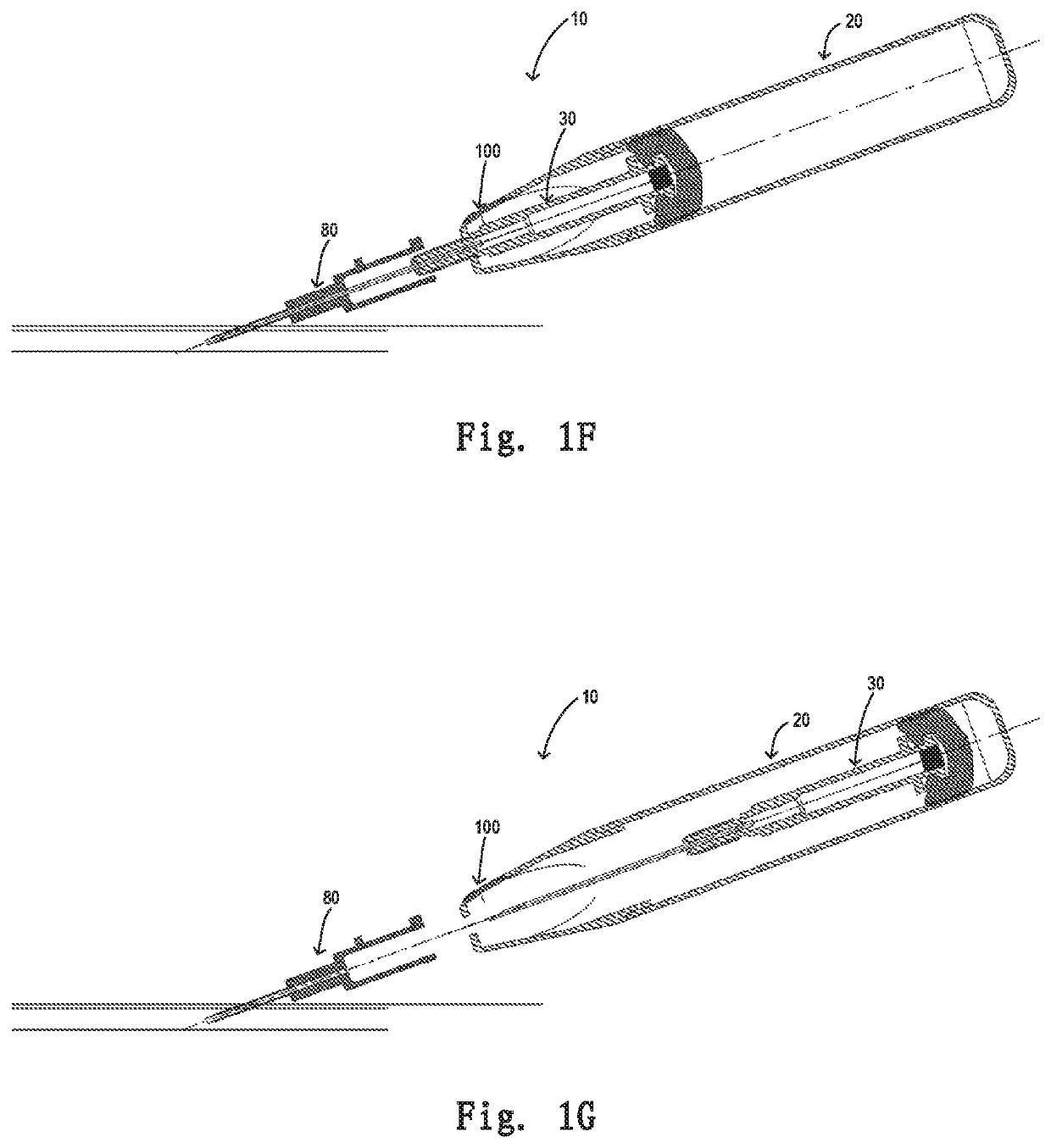 Safety mechanism for a retaining needle and a retaining needle having the safety mechanism