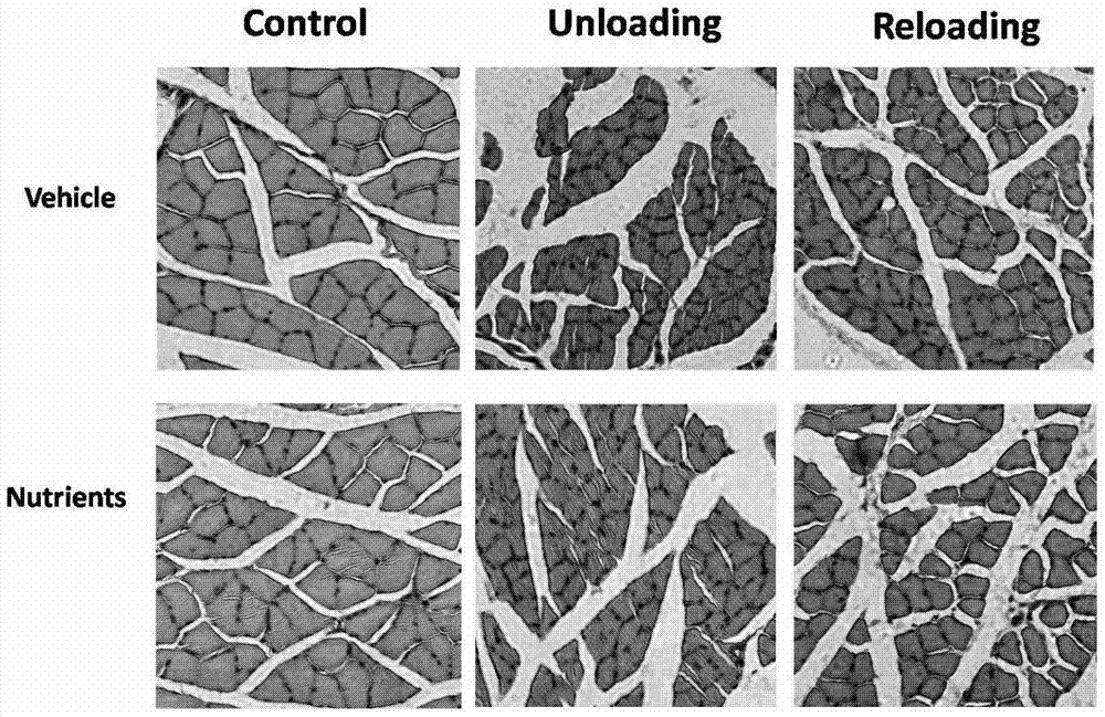 Application of alpha-lipoic acid, acetyl-L-carnitine, coenzyme Q10 and hydroxytyrosol composition for preventing and treating amyotrophy