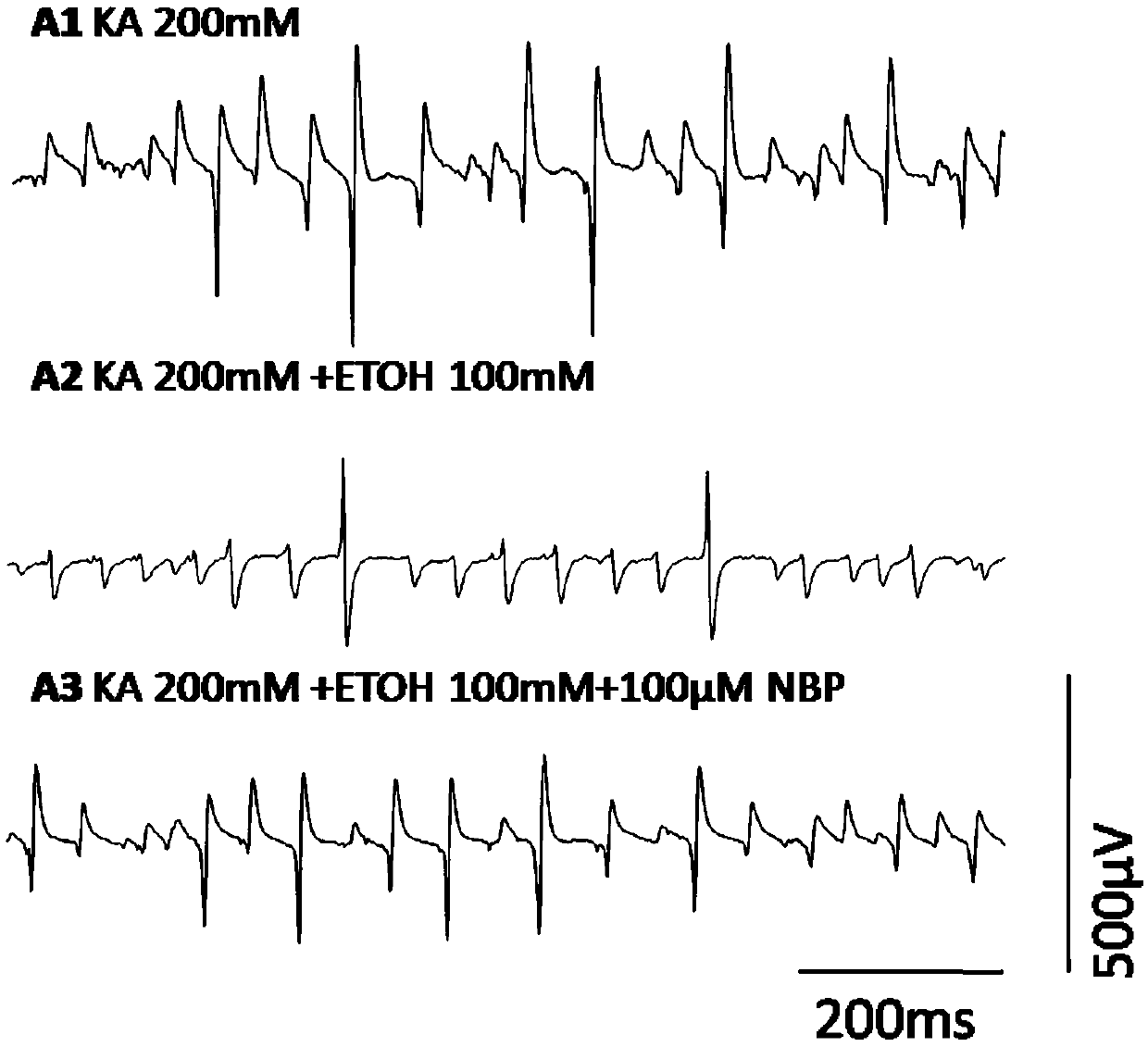 Application of dl-3-n-butylphthalide to protection of intracerebral hippocampus gamma network vibration caused by acute alcoholism