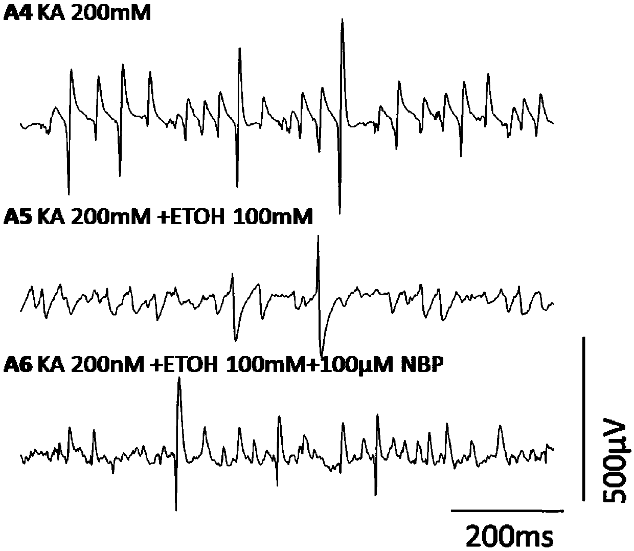 Application of dl-3-n-butylphthalide to protection of intracerebral hippocampus gamma network vibration caused by acute alcoholism