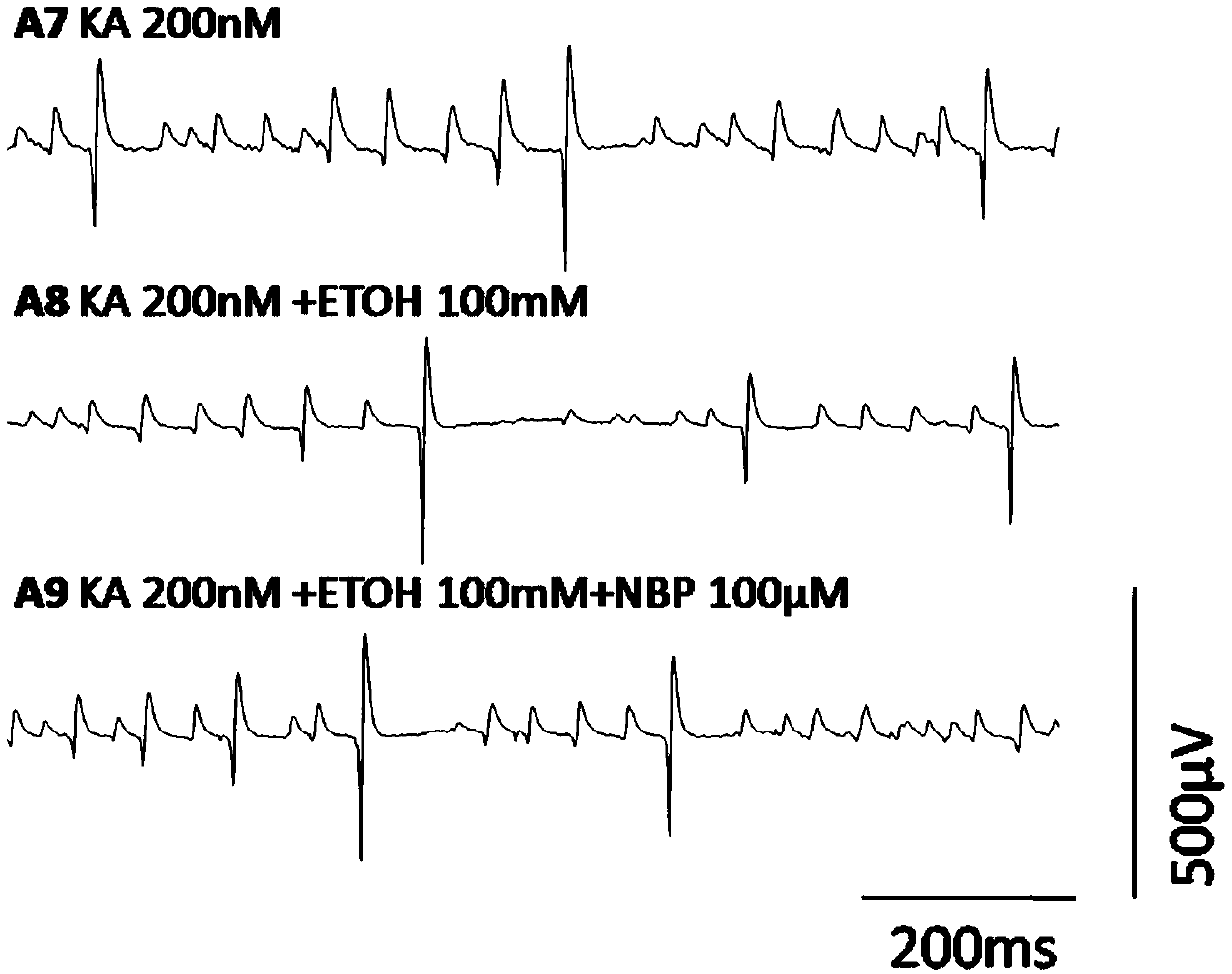 Application of dl-3-n-butylphthalide to protection of intracerebral hippocampus gamma network vibration caused by acute alcoholism