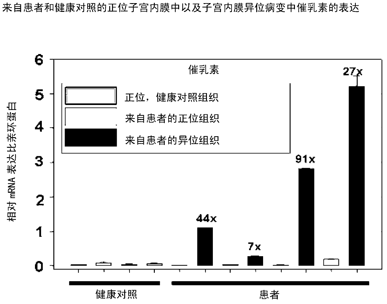 Neutralizing prolactin receptor antibodies and their therapeutic use