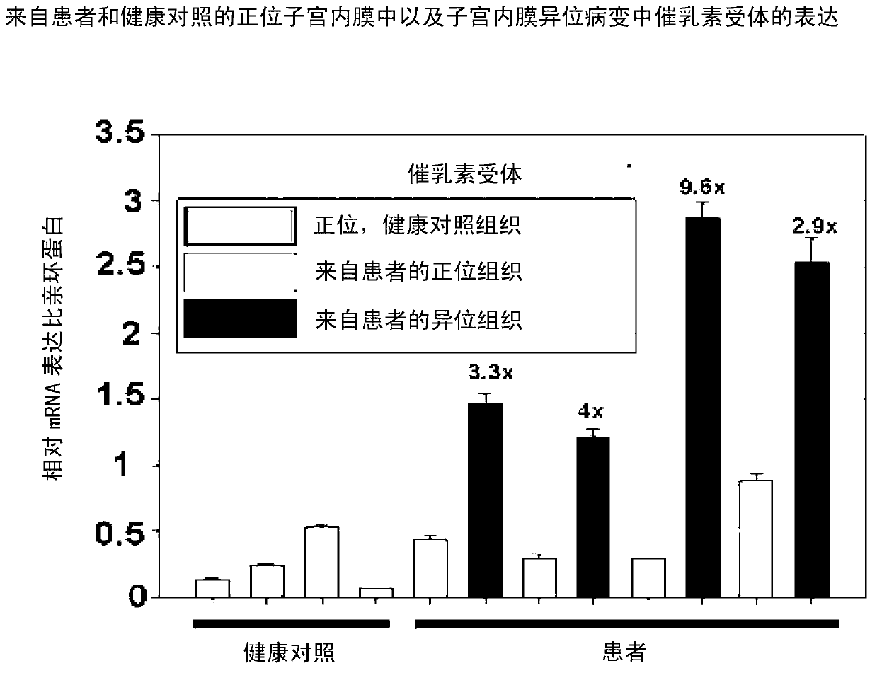 Neutralizing prolactin receptor antibodies and their therapeutic use