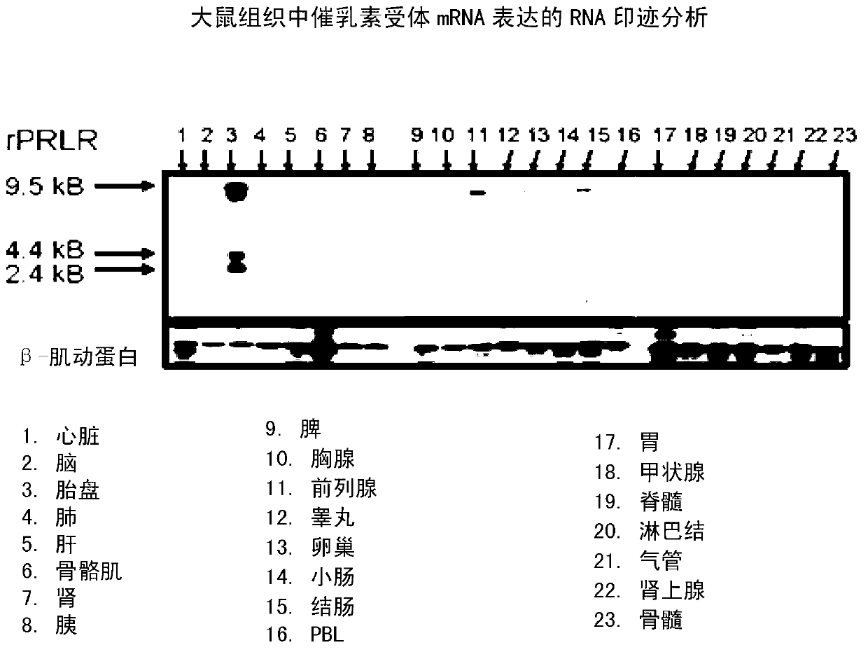 Neutralizing prolactin receptor antibodies and their therapeutic use